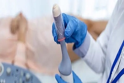 Ginekološki pregled, ginekološki ultrazvuk, PAPA test, kolposkopija i 3 brisa (Hlamidija, Mikoplazma, Ureaplazma)