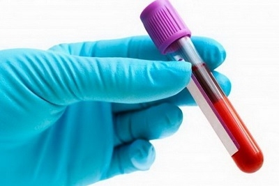 Tumor markeri (PSA, Free PSA, Index) za prostatu sa vađenjem krvi